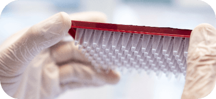 SPOT-it TREC & KREC Screening Kit