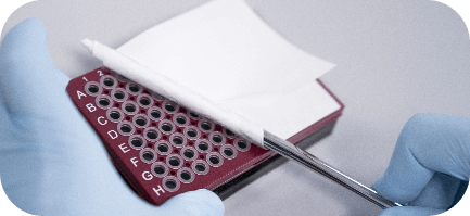 SPOT-it TREC & SMN1 Screening Kit